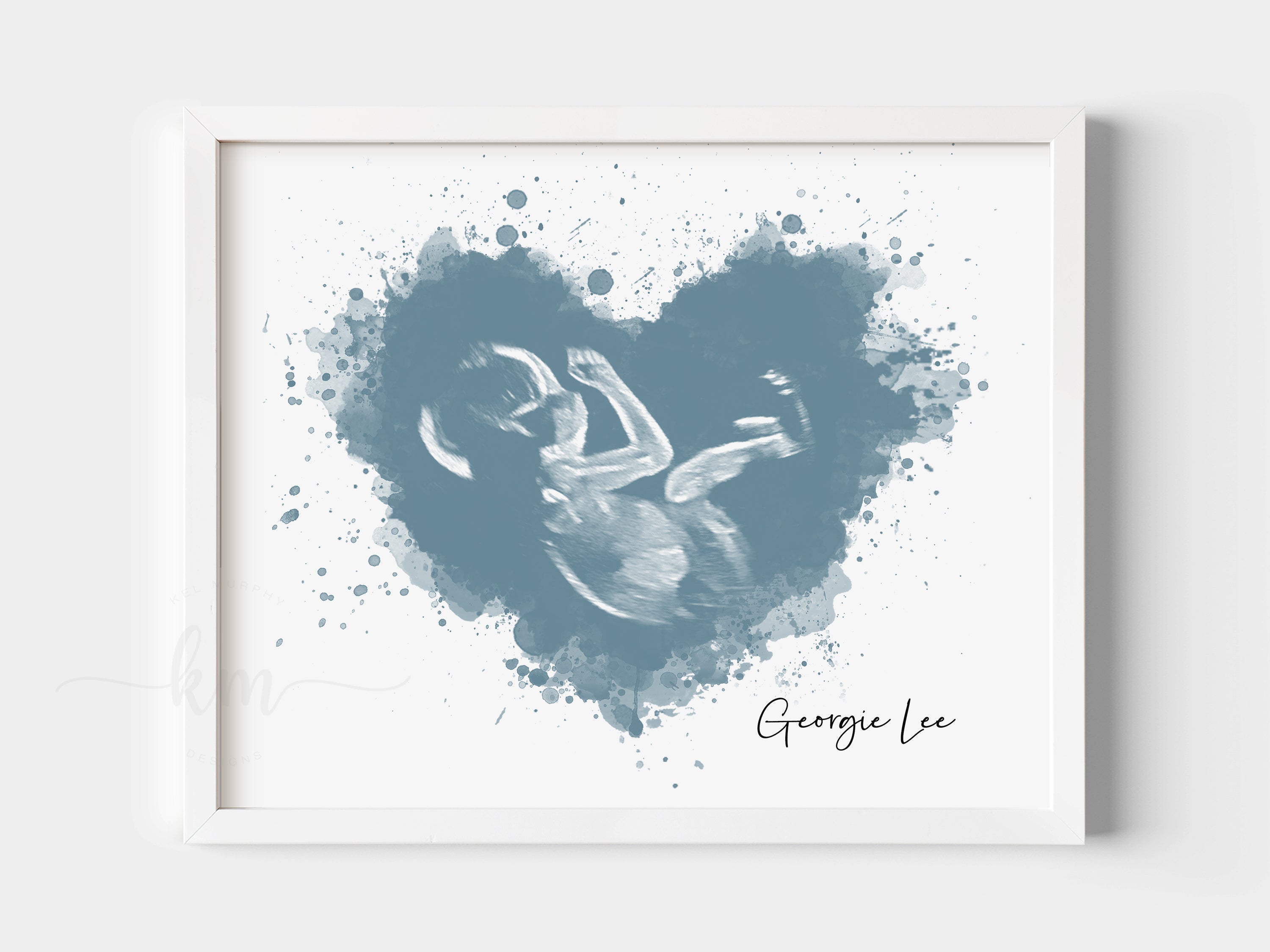 http://www.kelmurphydesigns.com/cdn/shop/files/Custom-Watercolor-Ultrasound-Art-Sonogram-Heart-Baby-Keepsake-New-Mom-Gift-Kel-Murphy-Design.jpg?v=1691350192