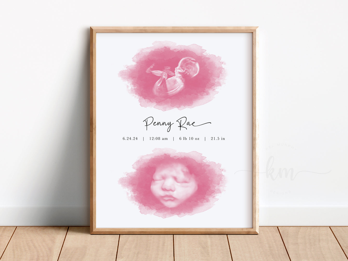 Two Ovals Watercolor Ultrasound Art