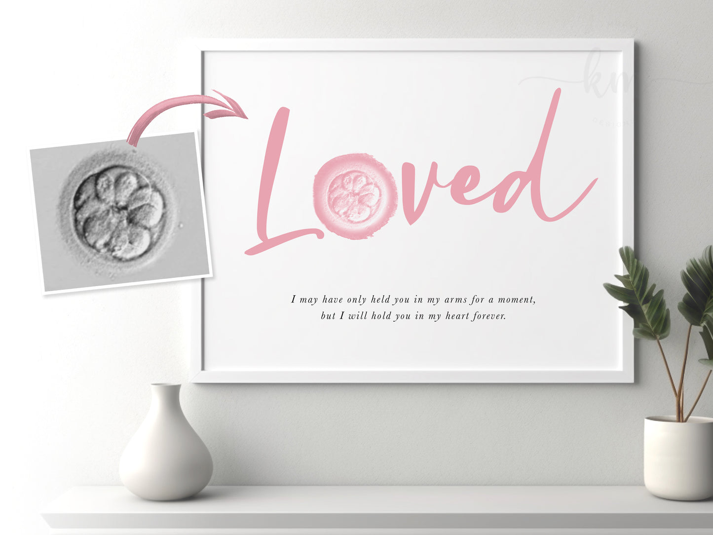 LOVED Watercolor IVF Embryo Art