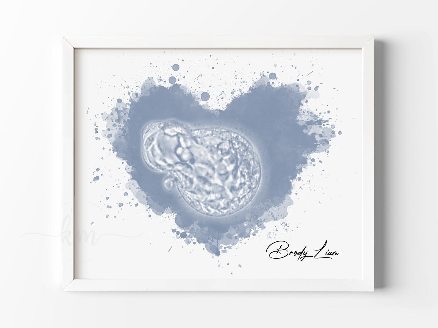 Splatter Heart Watercolor IVF Embryo Art