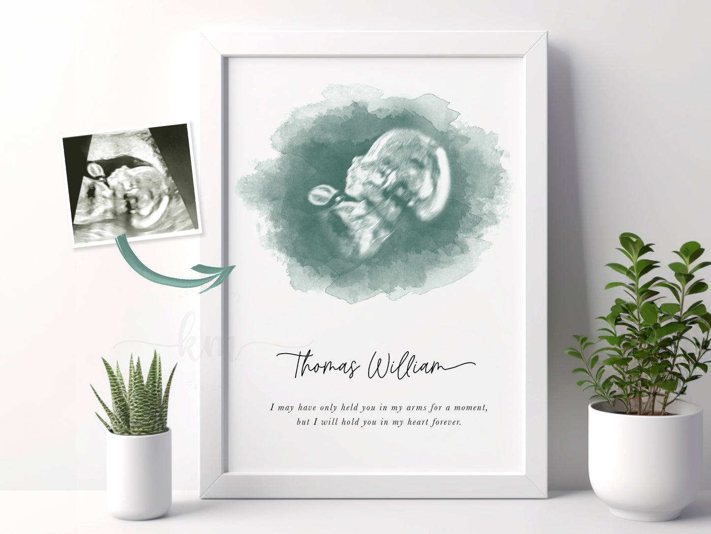 Oval Watercolor Ultrasound Art (Vertical)