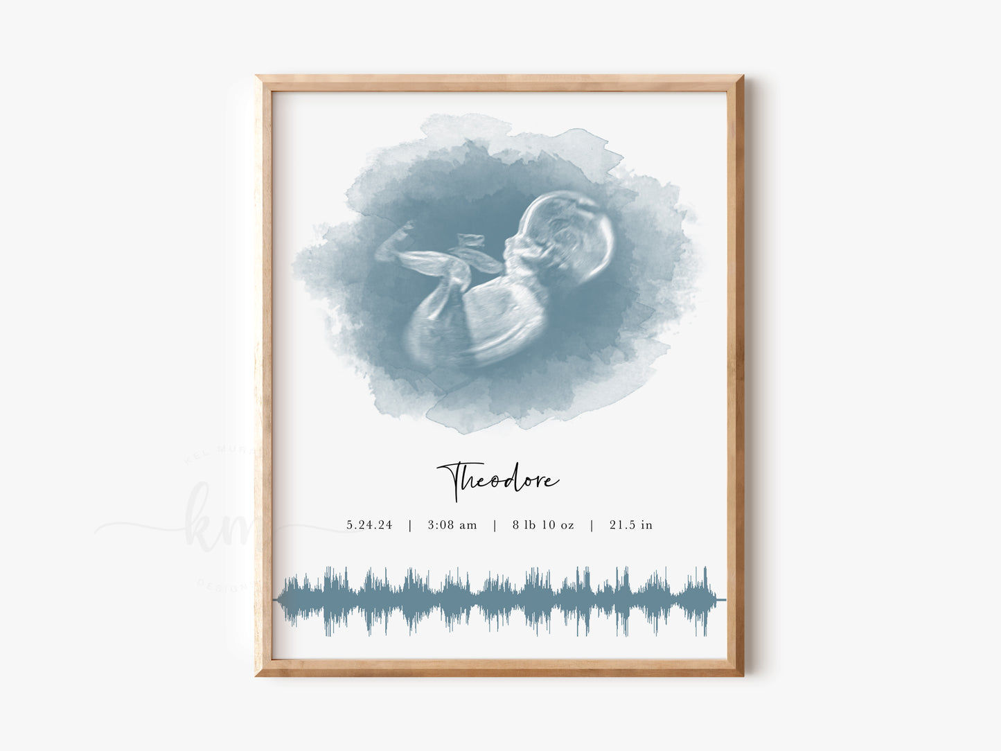 Oval Watercolor Ultrasound Art with Baby Heartbeat